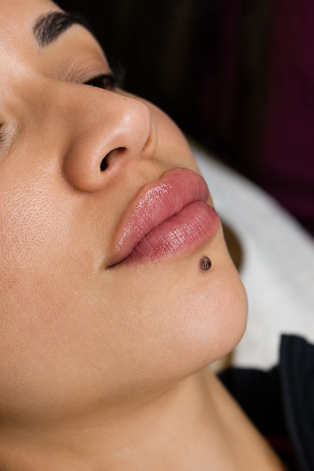 Detalle de labios tras tratamiento en Ziba